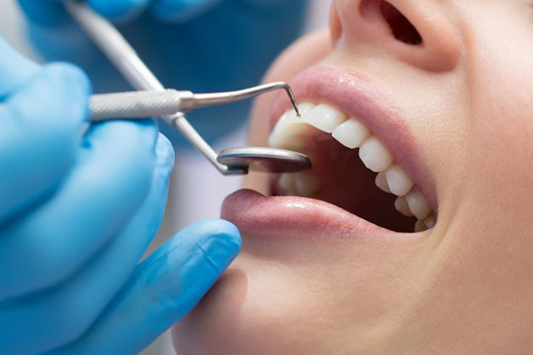 Teeth Bonding Coral Springs FL